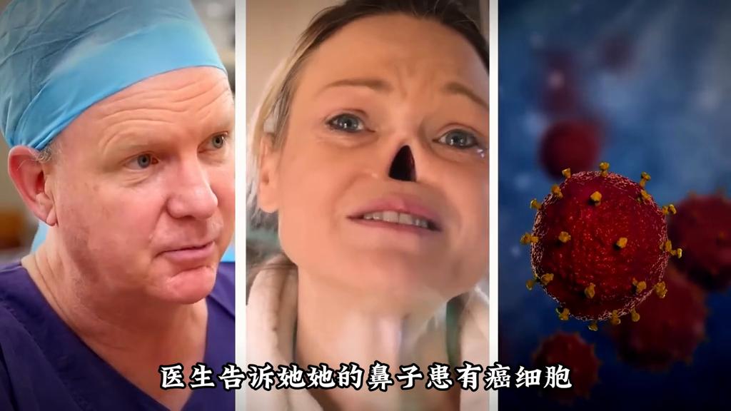 没有鼻孔的人长什么样,没有鼻孔的人视频