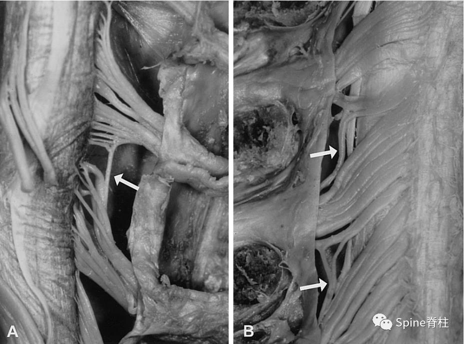 脊柱神经支配疼痛区域,脊柱神经支配的脏腑