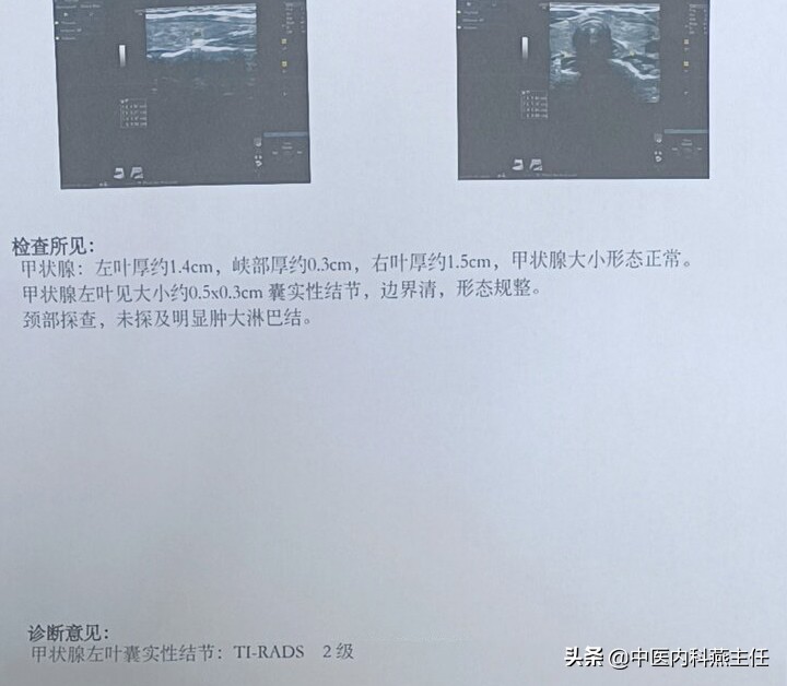 调理结节囊肿的名医,治结节囊肿的16味中药图片