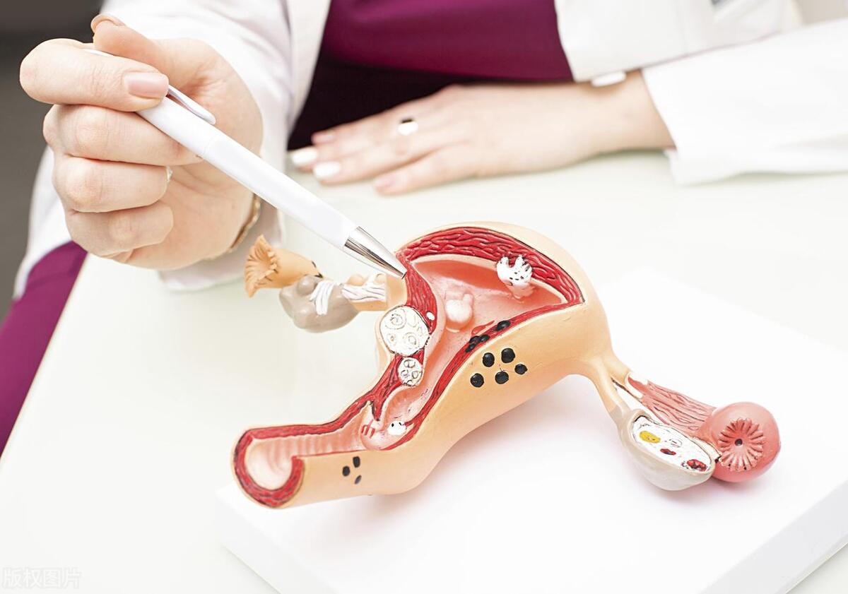 女性切除子宫后身体会有什么影响,女人切除子宫后还能排卵吗