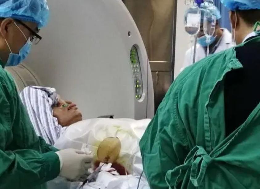 身体出现这8个症状，当心胰腺癌已找上门，及时发现趁早治疗