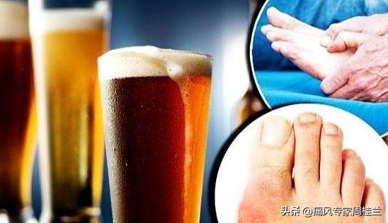 不想吃药怎样才能降尿酸,痛风可降尿酸最快的十大食物