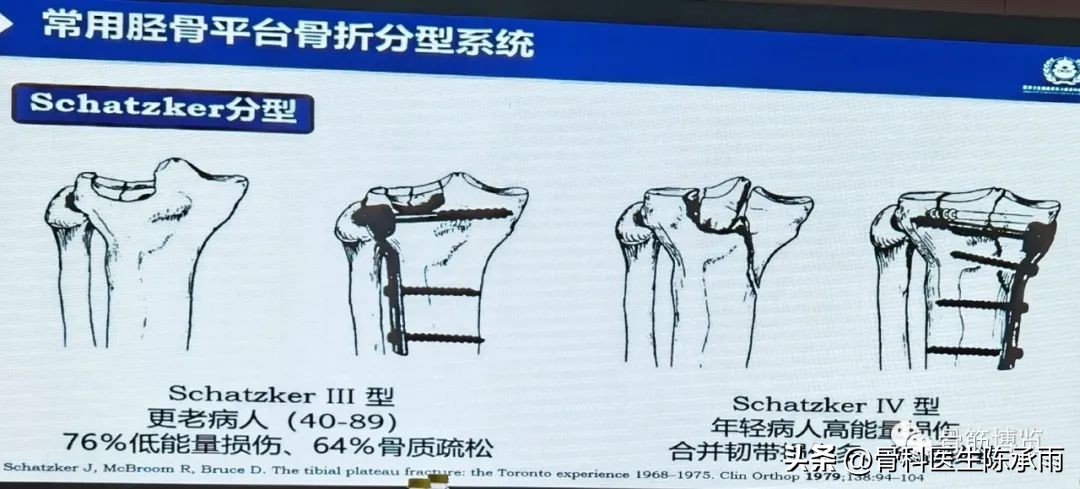 国家卫健委主办的骨创伤专项能力培训项目----下肢损伤学习班