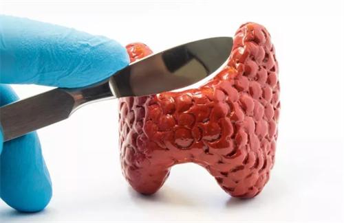 甲状腺结节吃2类9种食物快速散结,甲状腺结节要多吃高纤维素食物吗