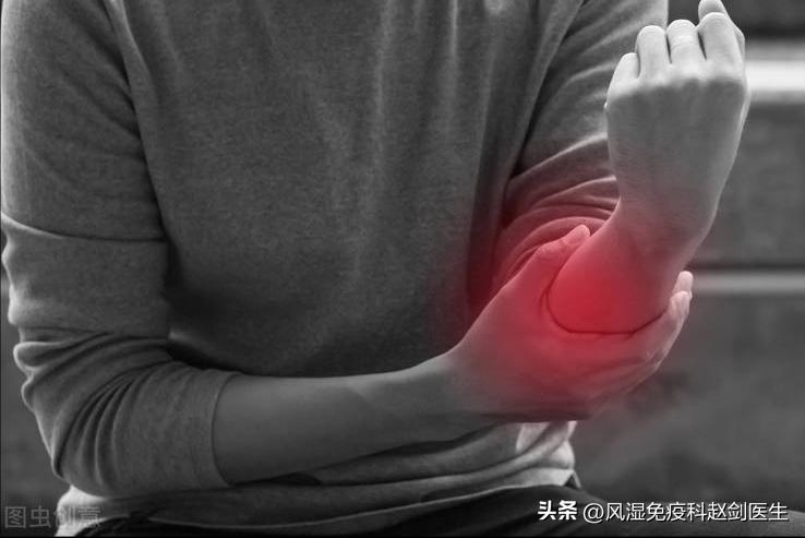 类风湿发现得早可以控制吗,怎么才能知道类风湿控制住了