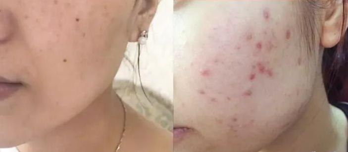 正品新款资生堂悦薇水乳中样套盒,资生堂悦薇水乳2020年双十一