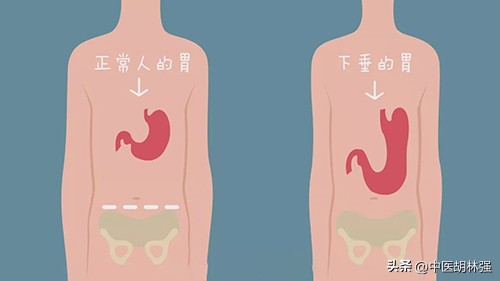 补中益气丸的神奇功效和现代用途,补中益气丸的功效和作用能减肥吗