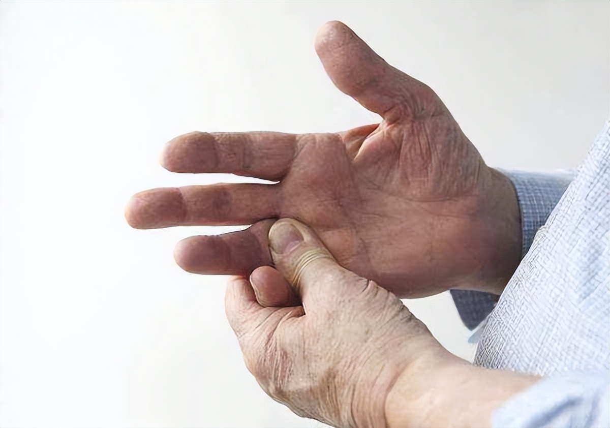 中医经方治手脚麻,手麻脚麻木偏方