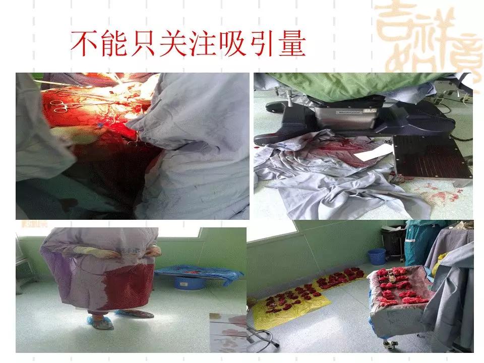 产科门诊给病人宣教课件,产科课件视频