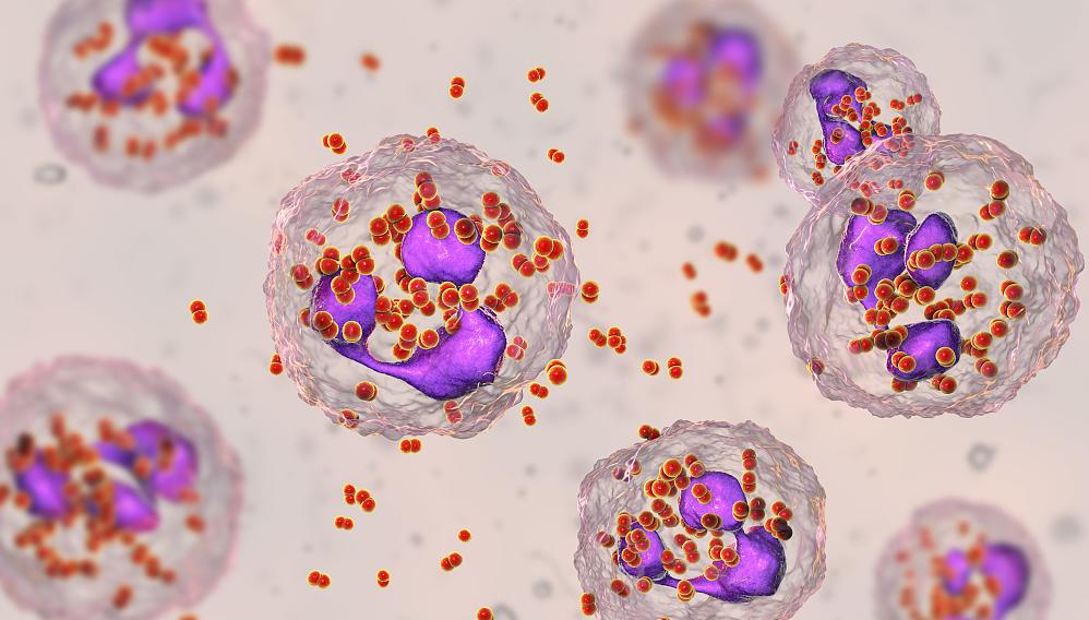 尿道炎有哪些症状？出现这些不适就得警惕了，可别大意