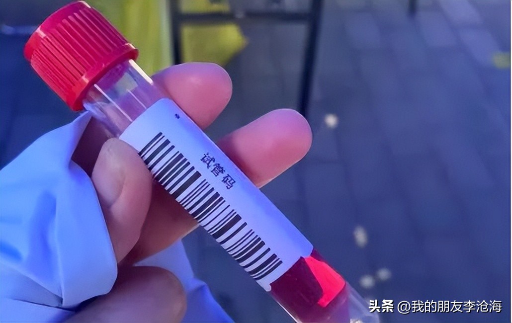 奥特曼给哥斯拉做核酸检测,奥特曼会做核酸吗