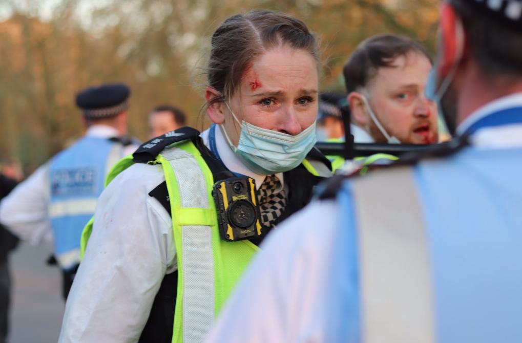 日本人兽杂交实验被允许，这是否违背伦理常纲？是创新还是灾难？