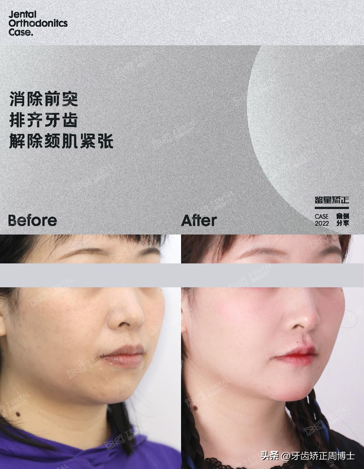 <html>
<head><title>502BadGateway</title></head>
<body>
<center><h1>502BadGateway</h1></center>
<hr><center>nginx</center>
</body>
</html>
<!--apaddingtodisableMSIEandChromefriendlyerrorpage-->
<!--apaddingtodisableMSIEandChromefriendlyerrorpage-->
<!--apaddingtodisableMSIEandChromefriendlyerrorpage-->
<!--apaddingtodisableMSIEandChromefriendlyerrorpage-->
<!--apaddingtodisableMSIEandChromefriendlyerrorpage-->
<!--apaddingtodisableMSIEandChromefriendlyerrorpage-->
