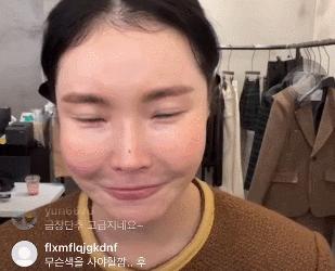 嘴唇薄变丰满,嘴唇变凸变丑怎么办