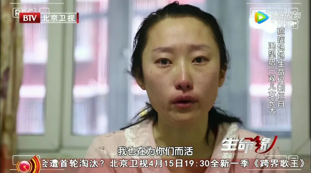 痣一旦有变化就是癌变吗,痣发生癌变时会有3种表现