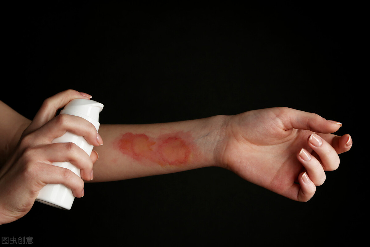 你们知道创可贴的正确用法吗,创可贴的妙用小技巧