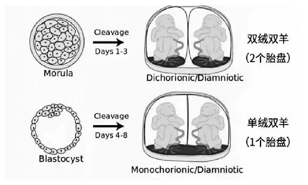 双胞胎母体内“打架”两败俱伤！“天使”护航平安降生