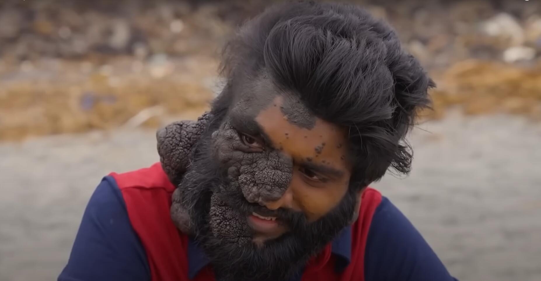 10个难以置信的人类，树皮人、外星人、拥有粗壮手臂的大力水手