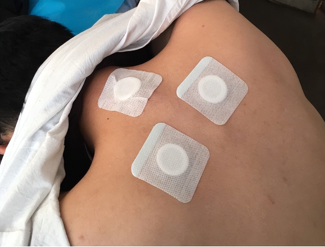 宝妈支气管发炎怎么办,宝妈得了支原体肺炎怎么办