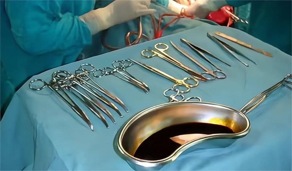 被小臂长的针刺穿阴道、卵巢，只为一部苹果手机，爱心捐卵何时休