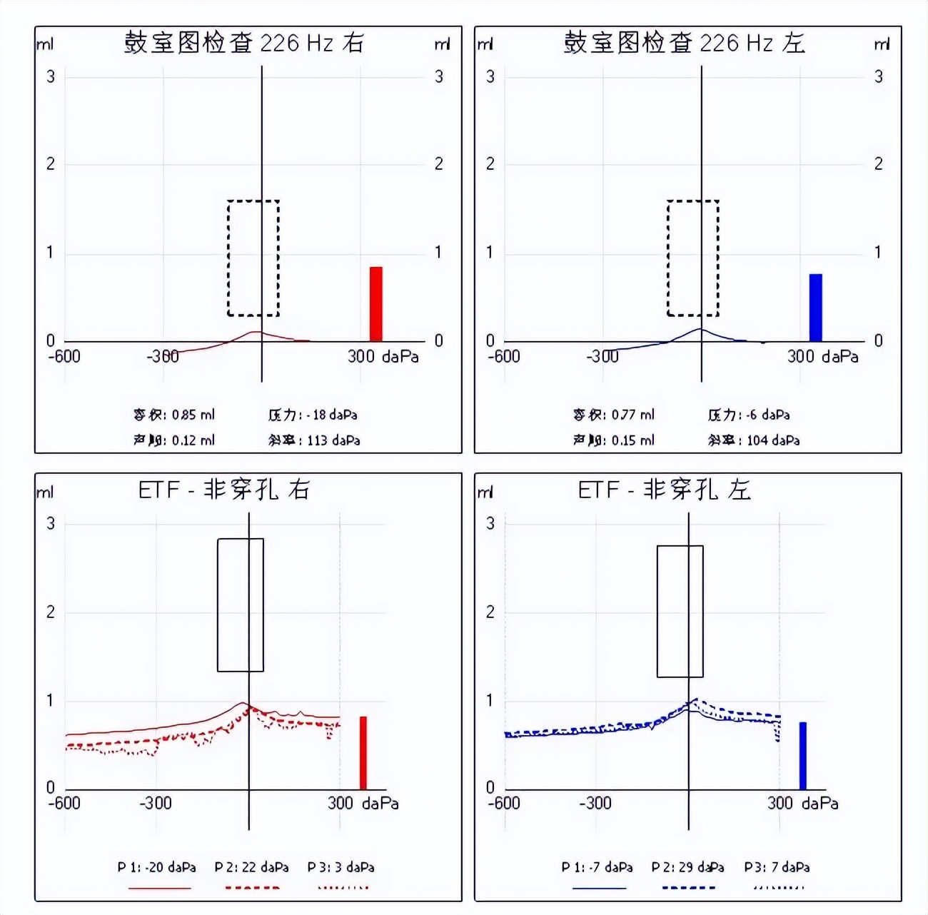 面肌痉挛耳后微创治疗,面肌痉挛外科微创诊治副作用