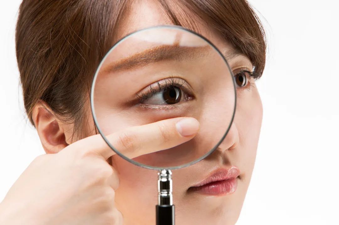 一觉醒来变成单眼皮是什么原因,一觉醒来眼皮一单一双是怎么回事