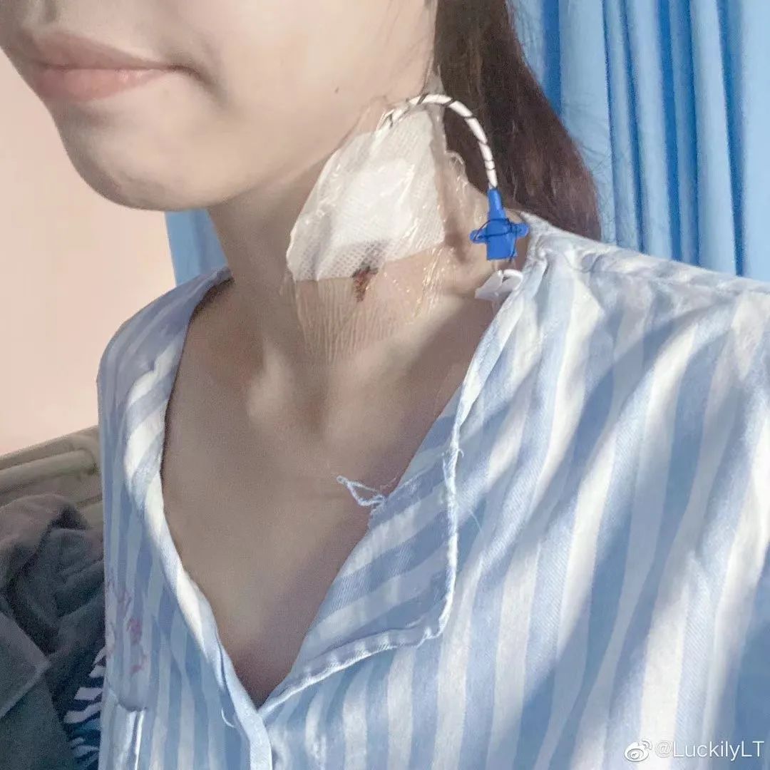 22岁护士实习,为安慰病人医生自述自己患癌