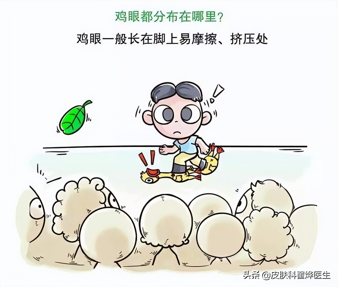 胼胝跖疣鸡眼怎么辨别,胼胝和跖疣鸡眼区别