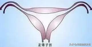 罕见女子2个子宫同时怀孕,罕见龙凤三胞胎