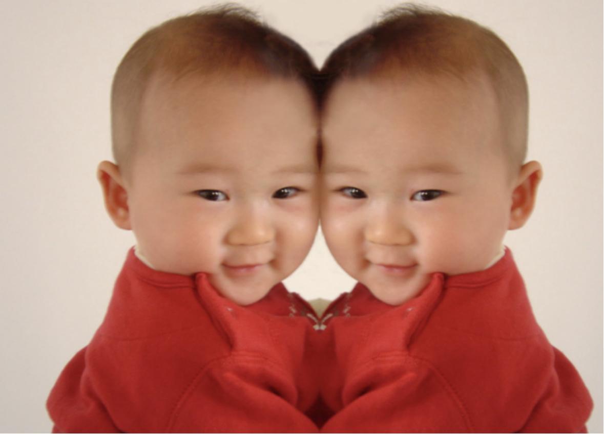 连体婴是不是有的共用一个大脑,两个大脑控制一个身体