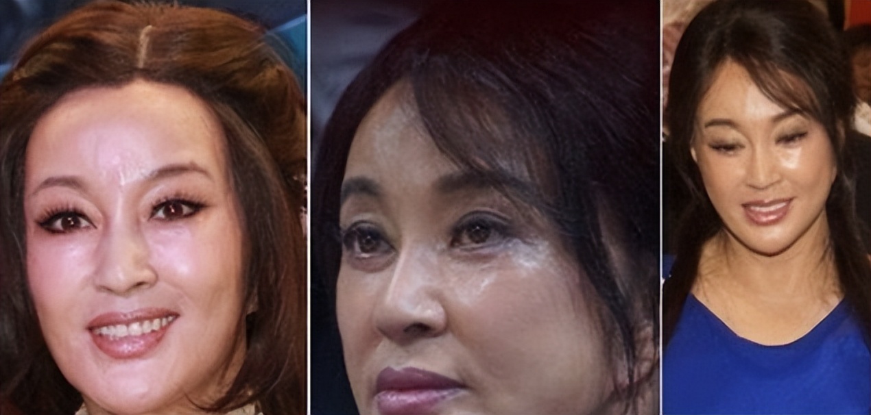 明星下颚骨整容后遗症,脸像鞋拔子怎么改善