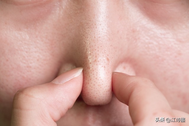 雅诗兰黛洗面奶男士最好的是哪款,碧欧泉男士洗面奶哪一款好