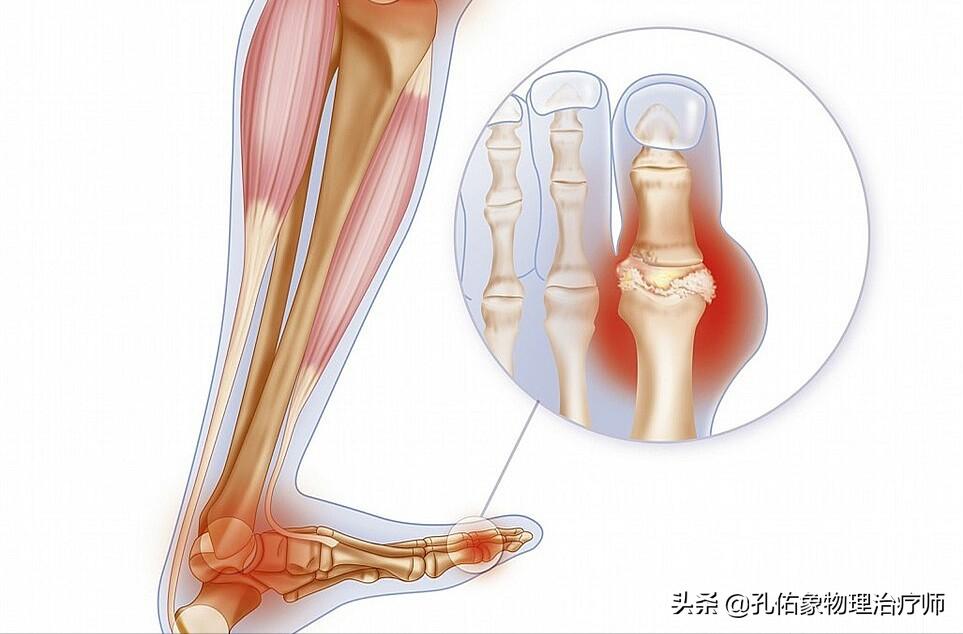 中老年人脚底痛是什么原因,老人脚底板好疼是什么原因