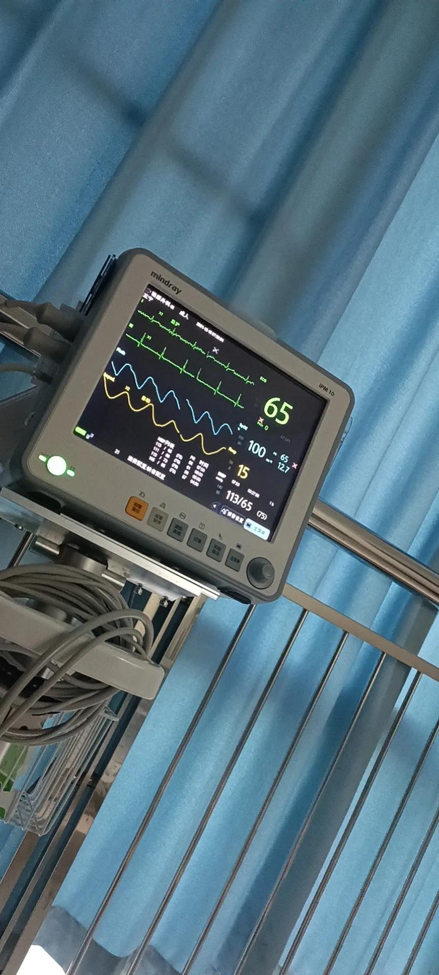 肾结石经皮肾镜两次手术间隔多久,两公分的肾结石需要动几次手术