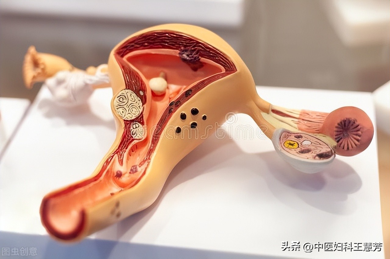 巧克力囊肿根治性手术,巧克力囊肿术后打六针后能备孕吗