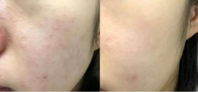 孕妇水乳孕妇专用第一名,孕妇水乳套装推荐第一名