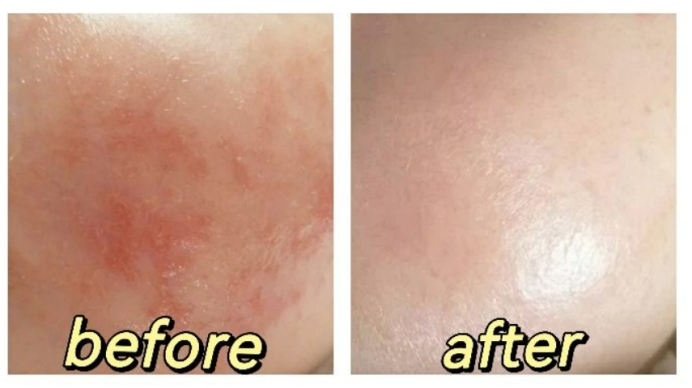 超市能买到的宝宝面霜,好用又实惠的宝宝面霜