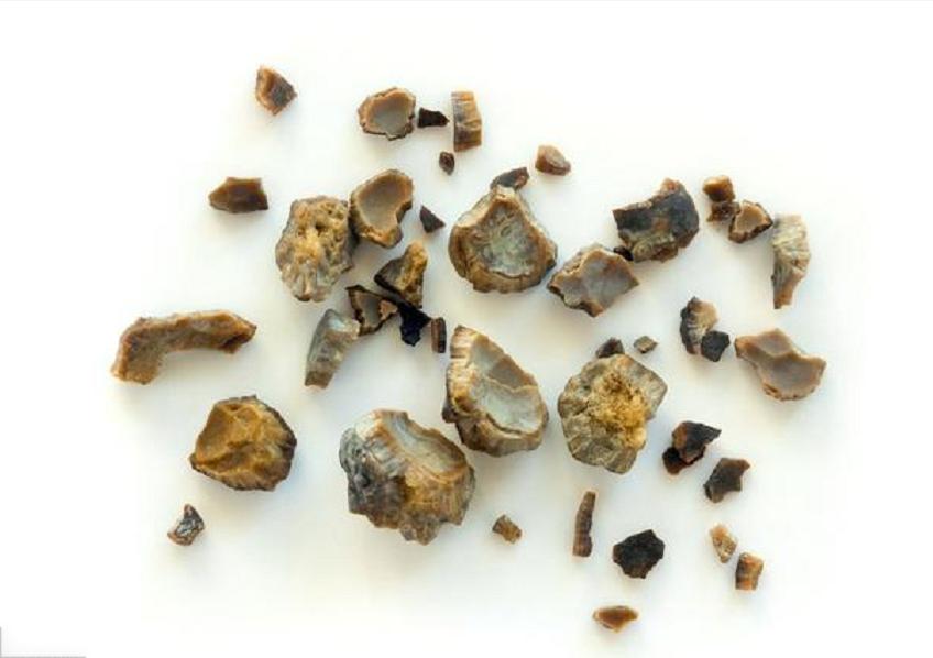 高僧体内的舍利子是怎样形成的,高僧舍利子怎么形成的科学解释