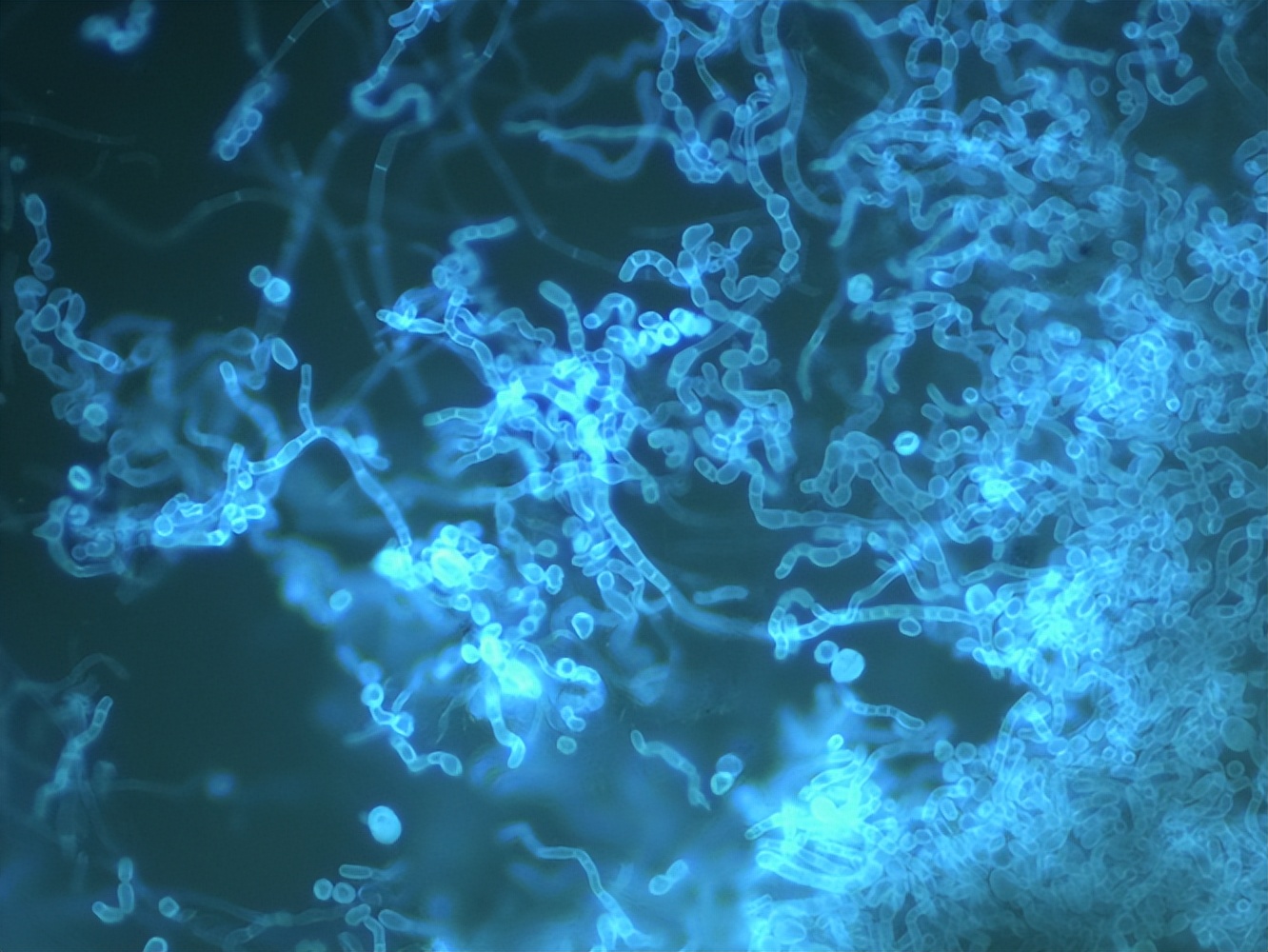 金黄色葡萄球菌的微生物特性,金黄色葡萄球菌的培养特性