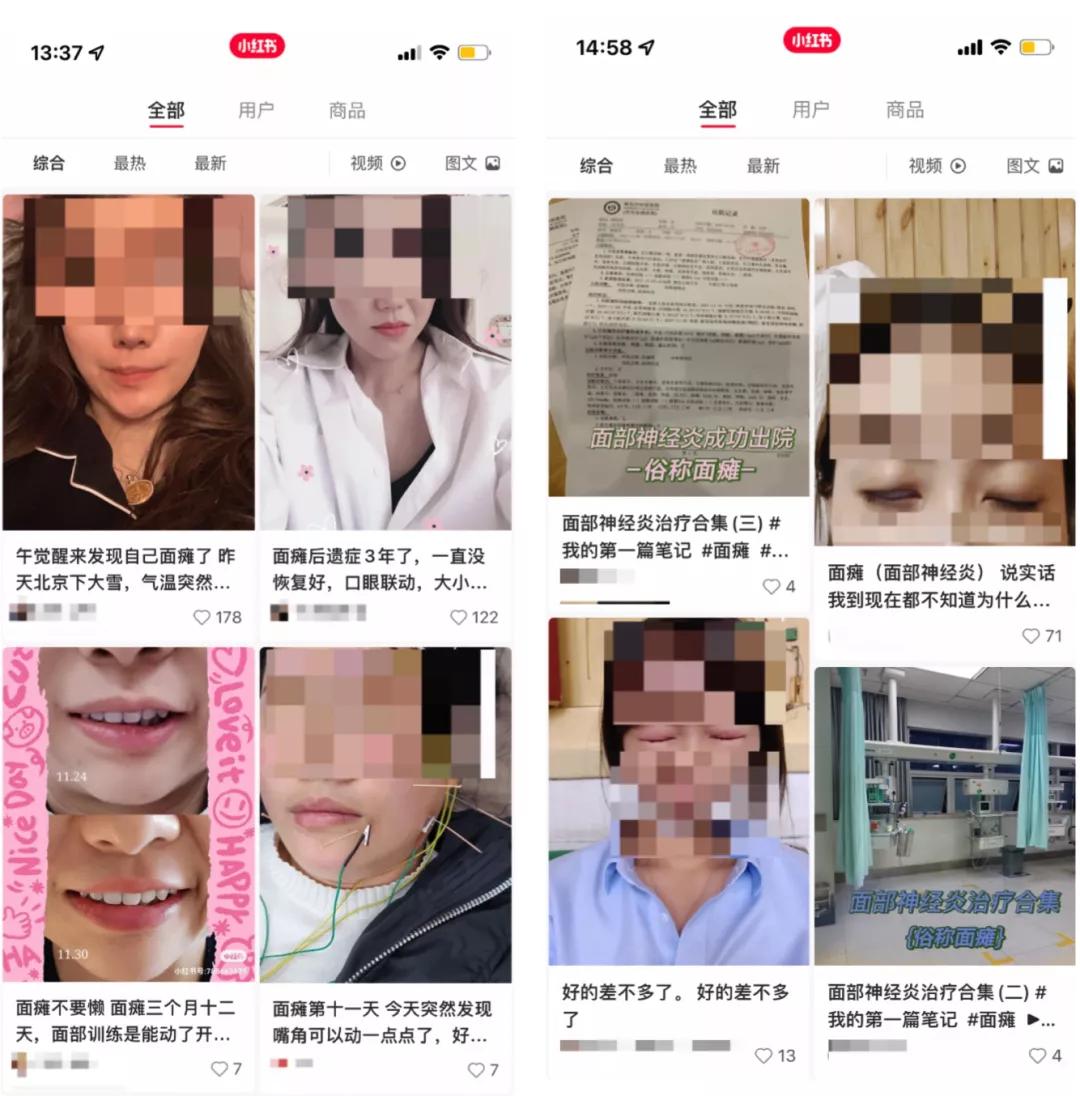 面瘫的人怎么进行人脸验证,面瘫人脸识别