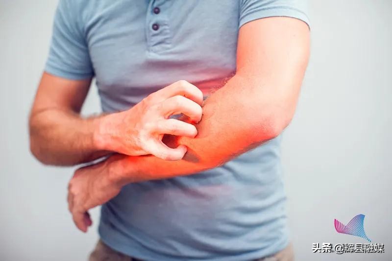 为啥身上痒痒,冬季身上干痒怎么办越挠越痒