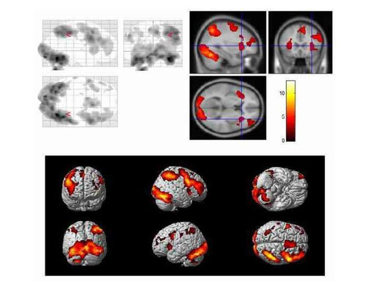 为什么人类总是喜欢和长相好看的交配繁衍？