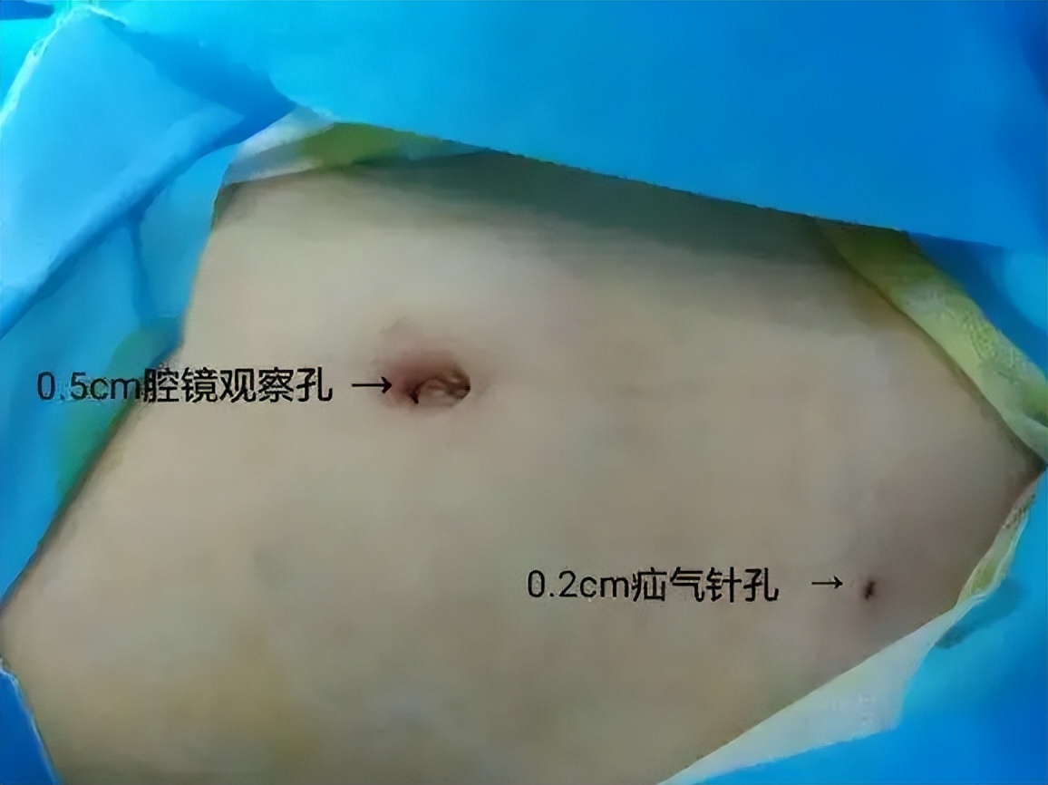 小男孩老是肚子痛怎么回事,男孩小肚子疼是小肠换气吗