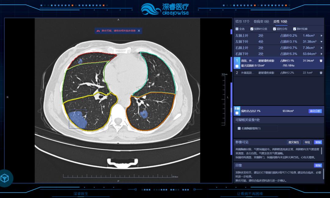美国最新治疗肺癌特效药,治疗癌症需要的工具