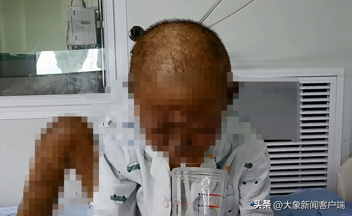 13岁男孩患怪病皮肤发黑浑身奇痒