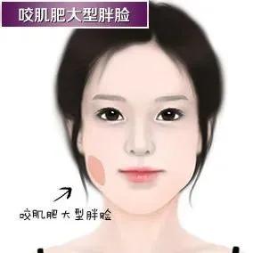 怎么确定是咬肌还是下颌角,怎么判断下颌角肥大还是咬肌大