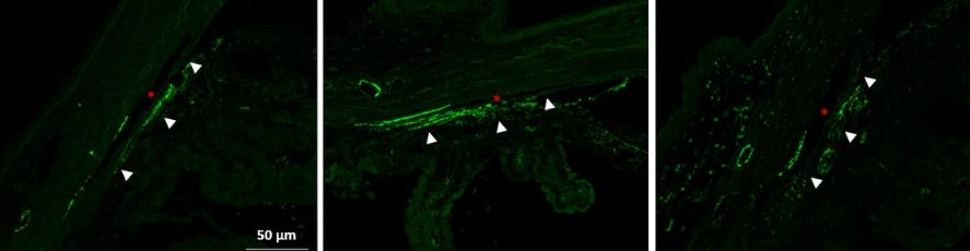 rho激酶抑制剂多少钱,rho激酶抑制剂是什么