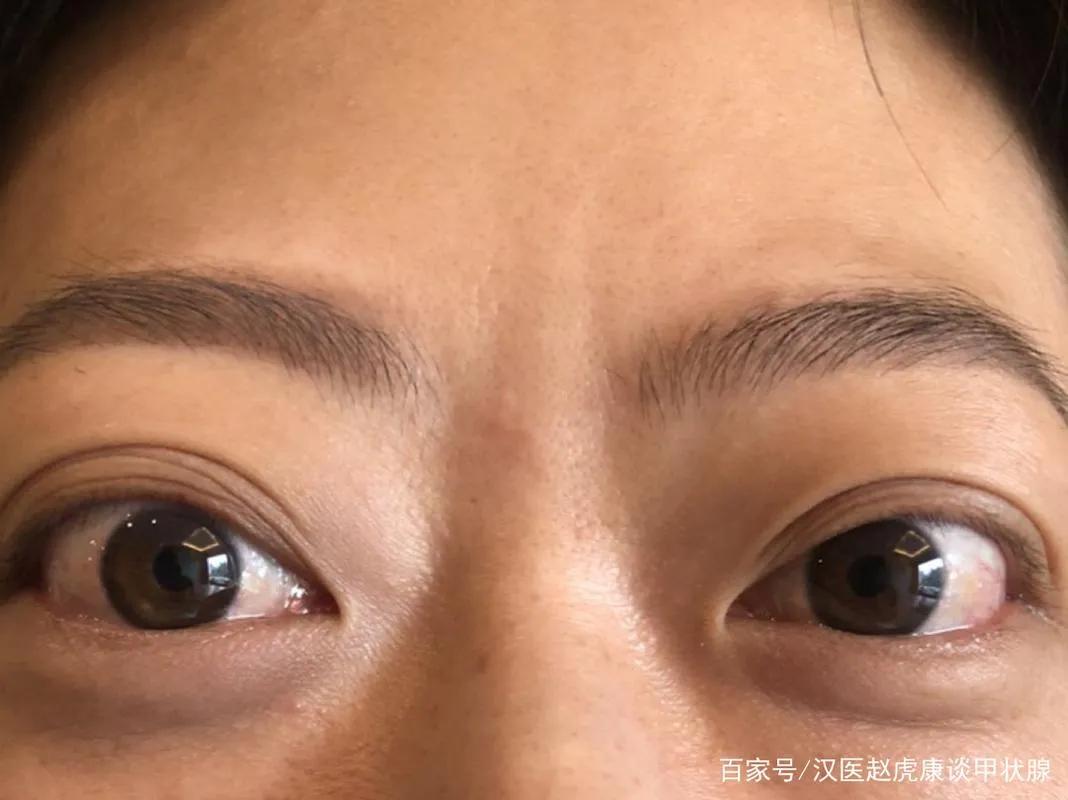 眼睛是否看出一个人的健康状态,如何通过眼睛辨别健康