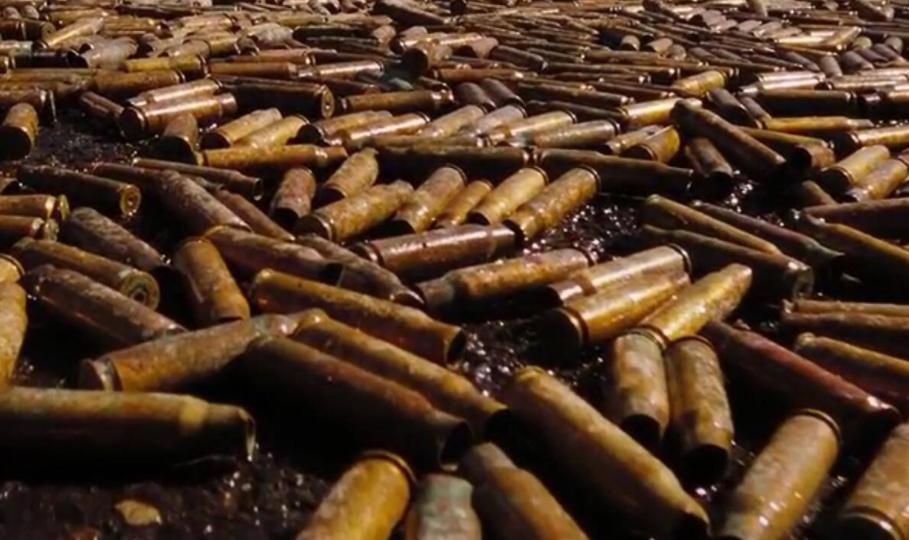 故事:江苏70岁老人头疼欲裂,检查时发现颅内有*弹子**,吓坏在场医生