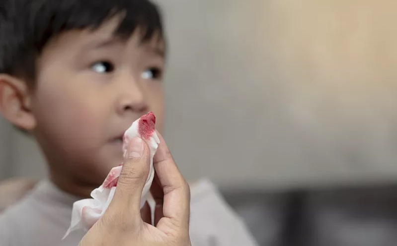 孩子流鼻血怎么快速止血,流鼻血别仰头一招让你快速止血